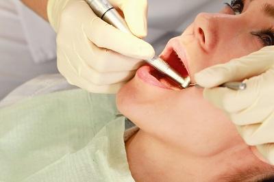 girl during teeth cleaning in vienna va