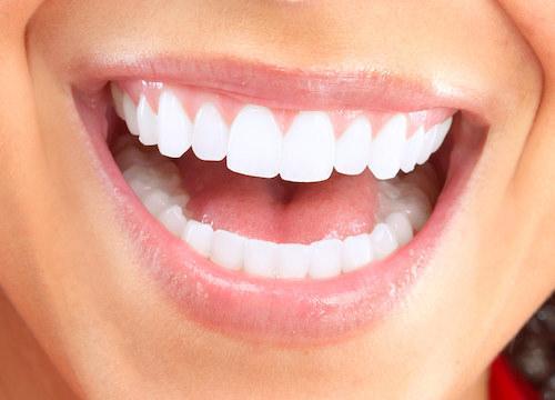 Woman | Dentist Vienna VA