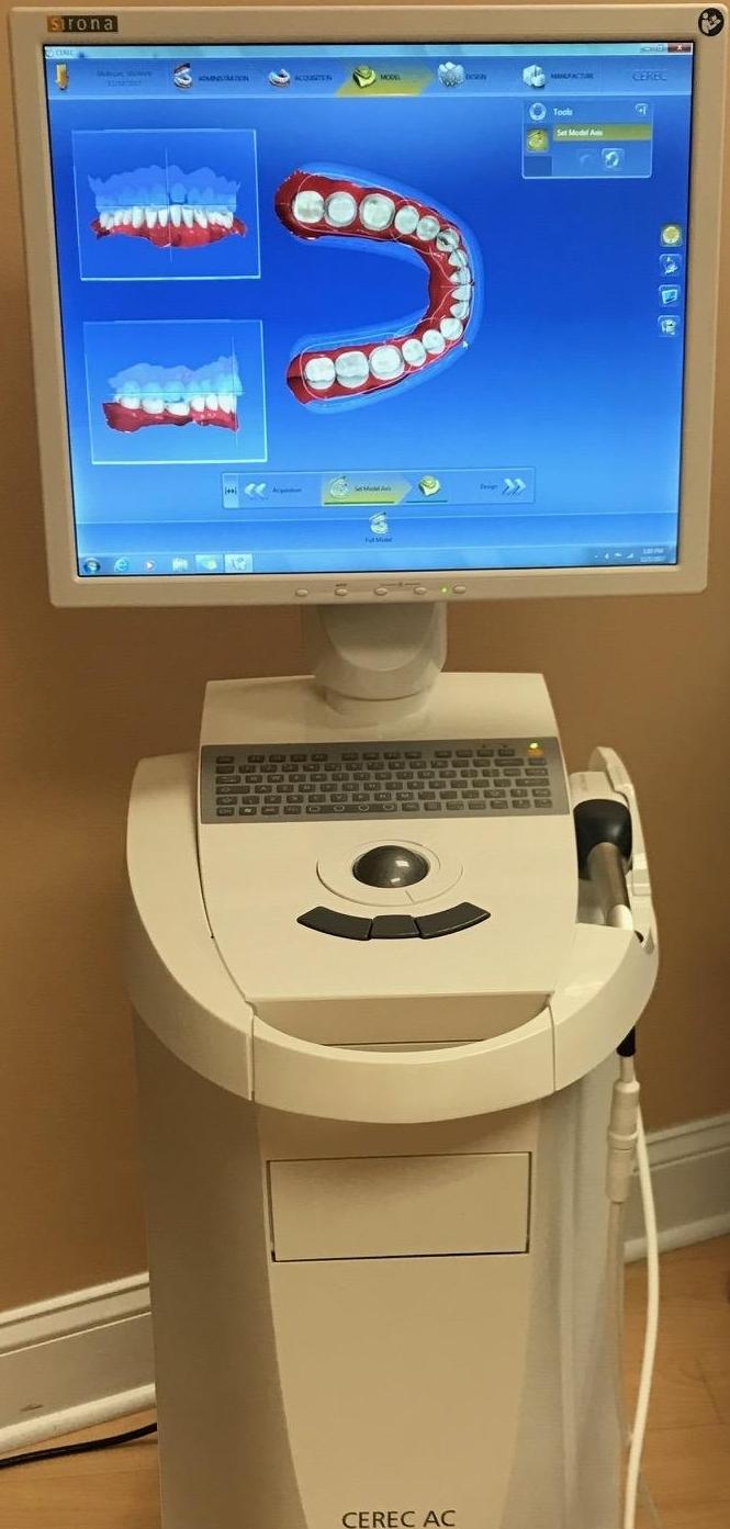 our CEREC, same day crown machine at work | dental crowns vienna va